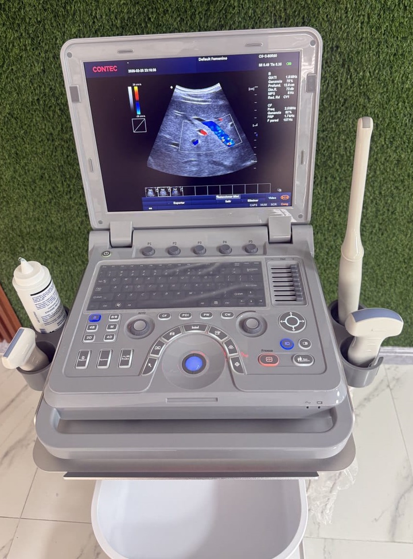 Ecógrafo CMS1700A