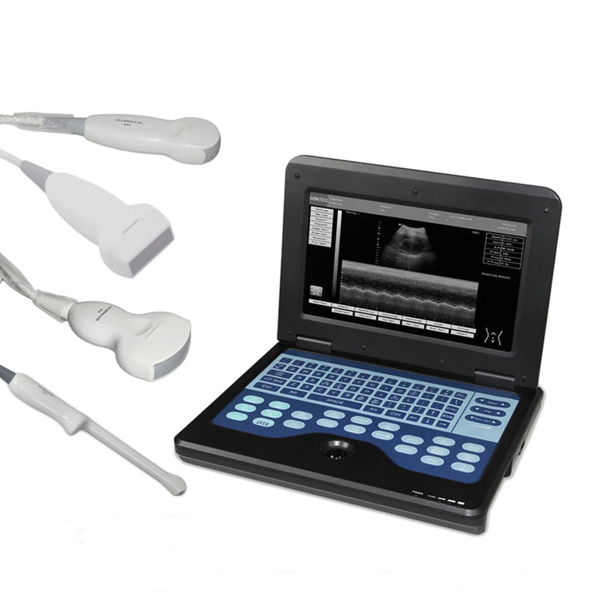 Vista 1 Ecógrafo CMS600P2